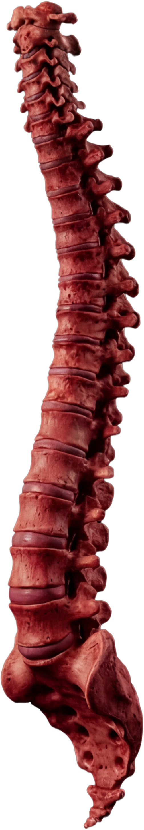 Red spine